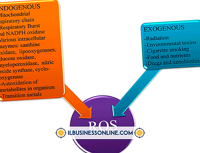 Faktorer som kan vara endogena och exogena i ett företag